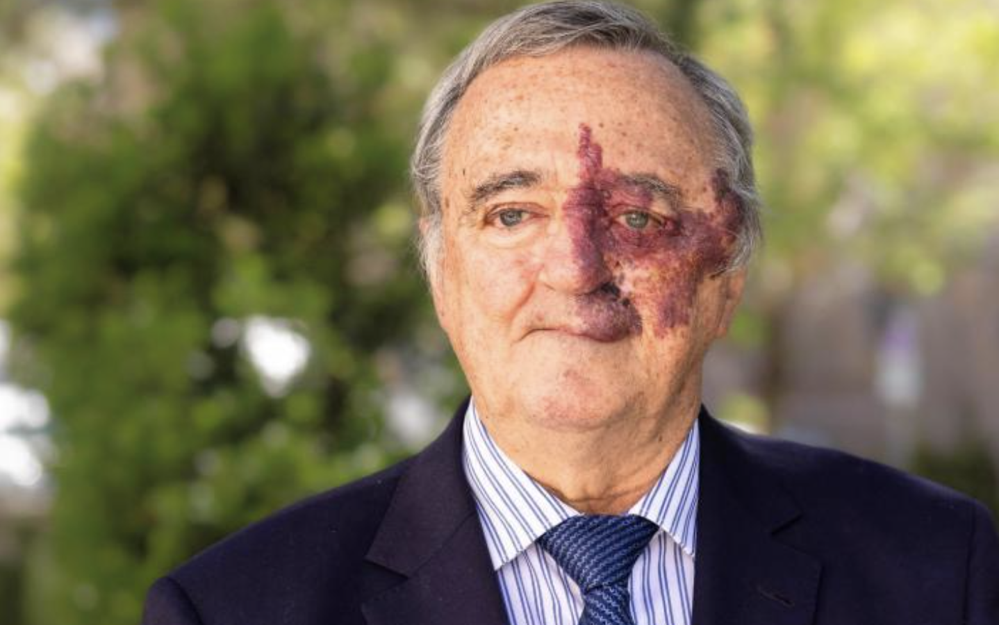 Barbacid niega querer lucrarse con su investigación contra el cáncer de páncreas