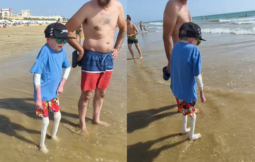 Leo, el niño con piel de mariposa, se moja los pies y las manos en la playa tras su novena dosis: 