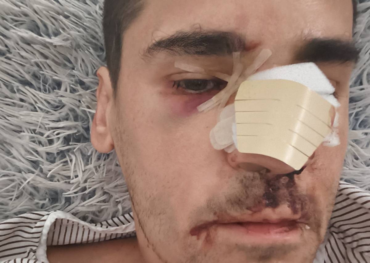 El periodista isleño Fonsi Loaiza, víctima de una brutal agresión: 