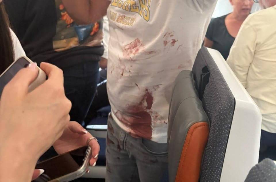 Dos pilotos acaban ensangrentados tras un apuñalamiento en pleno vuelo a Tel Aviv: Israel investiga si se intentó secuestrar el avión para un '11-S'