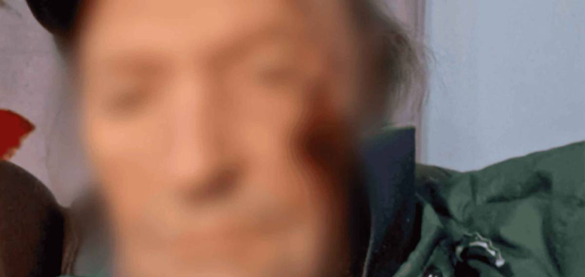 Amador Mohedano, con el rostro desfigurado tras una caída en Chipiona paseando a sus perros