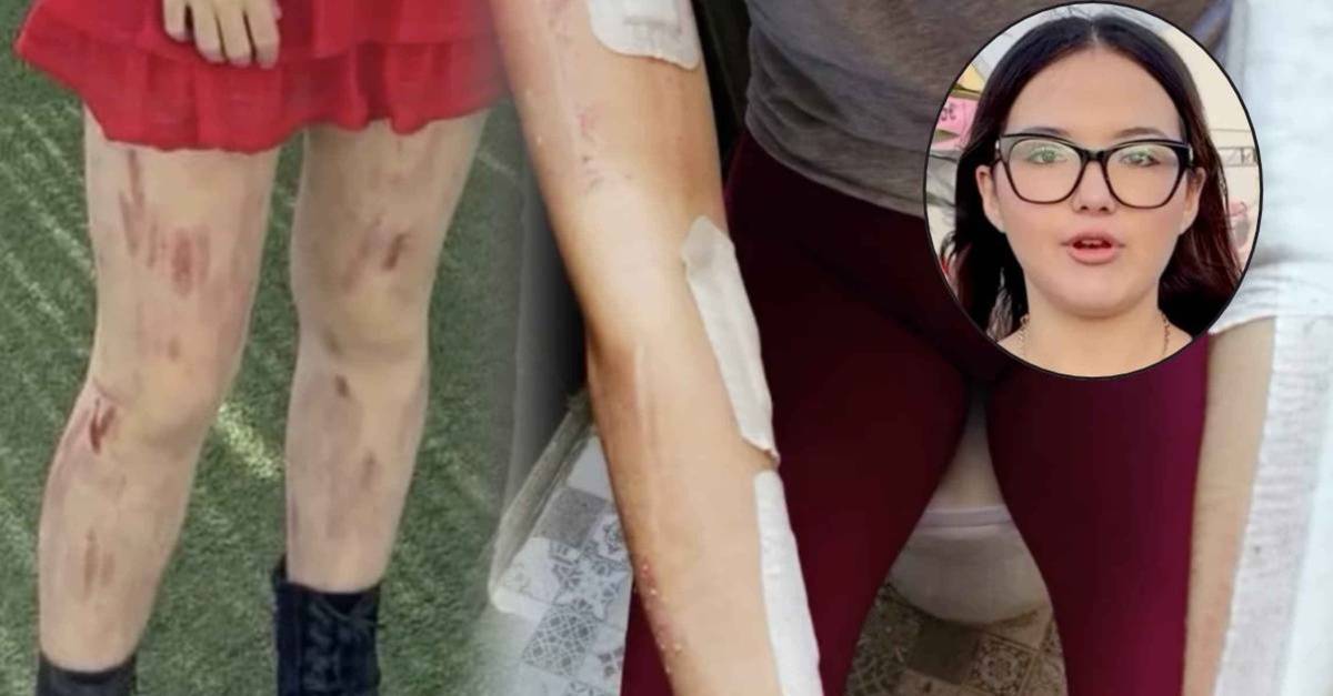 La campaña solidaria para ayudar a Mayte, una joven que lleva tres años entre hospitales por culpa del 'bullying'