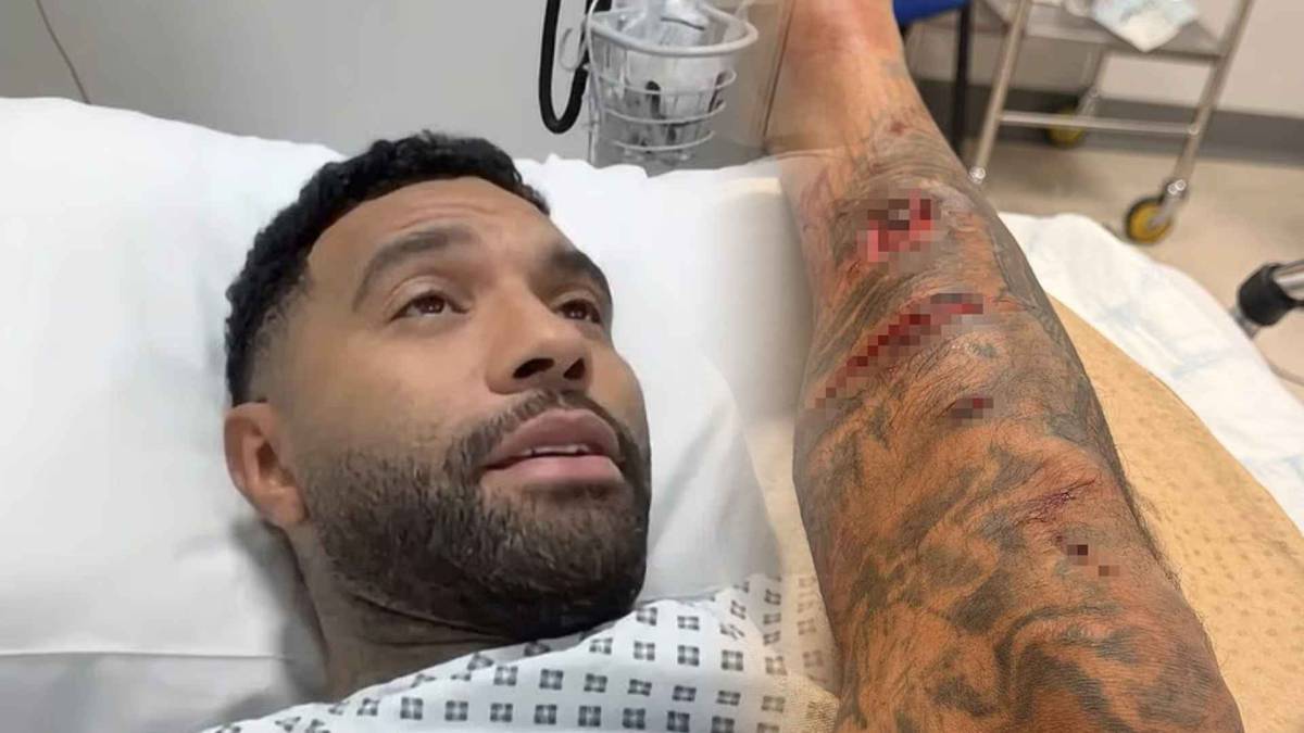 Más de 50 puntos de sutura: el brutal ataque sufrido por un exfutbolista que estuvo a punto de fichar por el Real Madrid