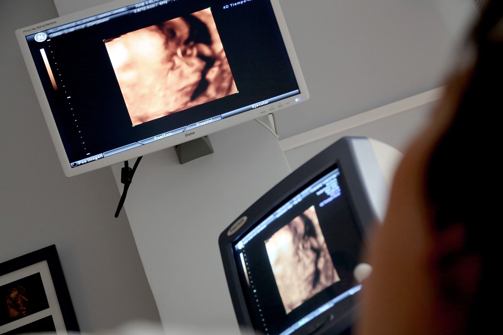 La Junta licita por 35 millones de euros los contratos para los abortos en las primeras 14 semanas del embarazo