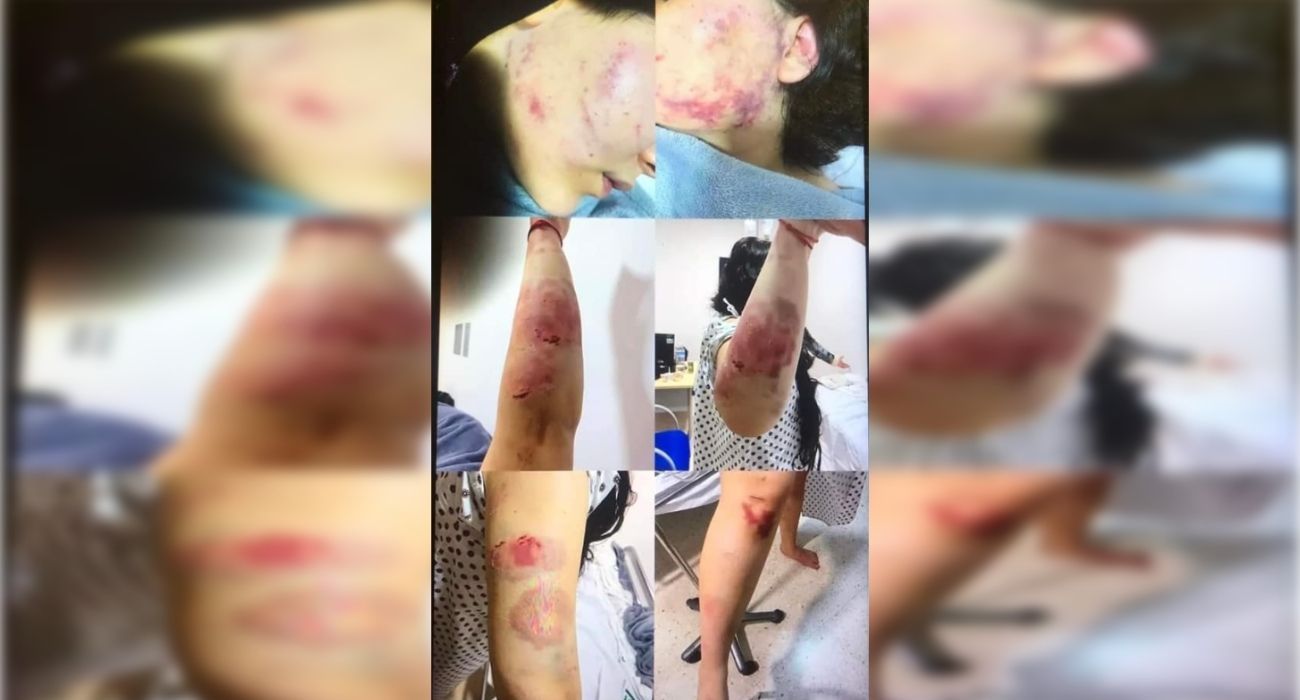 Imágenes de las heridas sufridas por la joven tras la brutal agresión. 