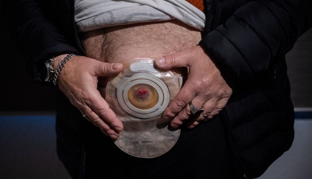 Una persona portadora de una ostomía. 