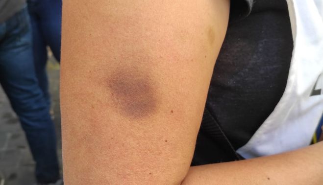 Signos de violencia por parte de la policía.