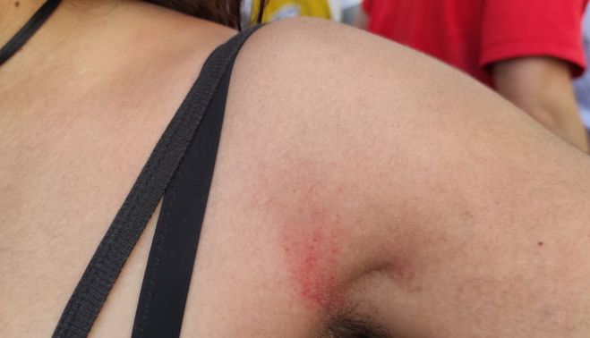 La resistencia ha sido pacífica, pero el forcejeo ha derivado en varias personas heridas.